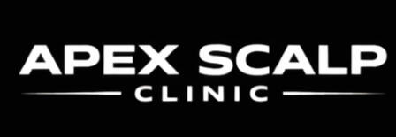 Scalp Micropigmentation Treatment for Hair Loss Scalp micropigmentation (SMP) treatment for hair loss performed in Palm Beach County